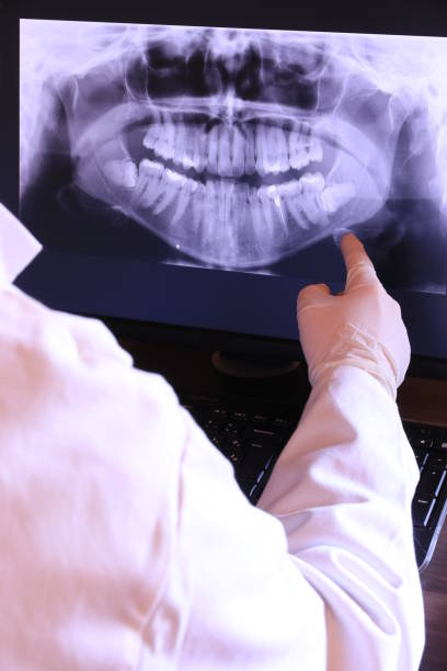 Best Emergency Wisdom Teeth Removal in St Clair, MI