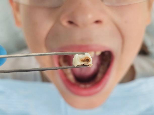 Best Emergency Dental Surgery in St Clair, MI